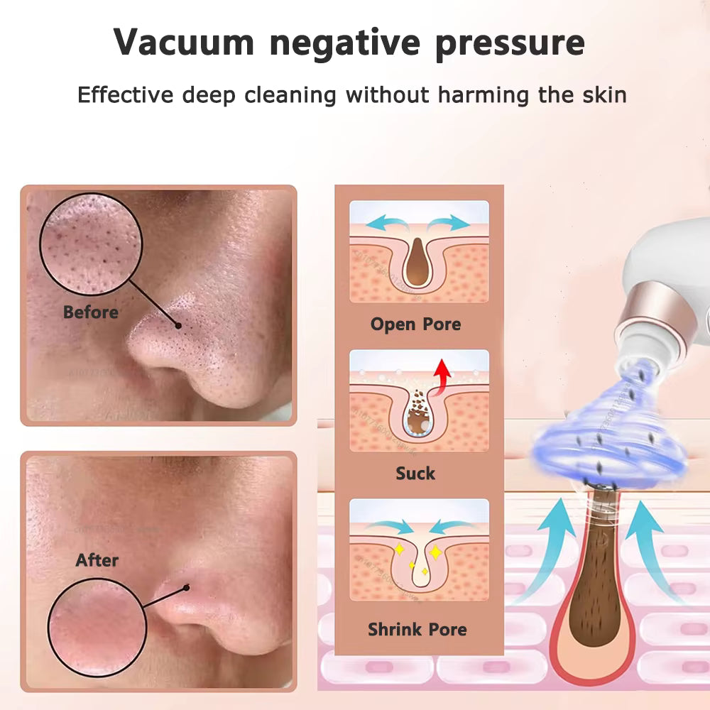 ClearPore Pro Vac