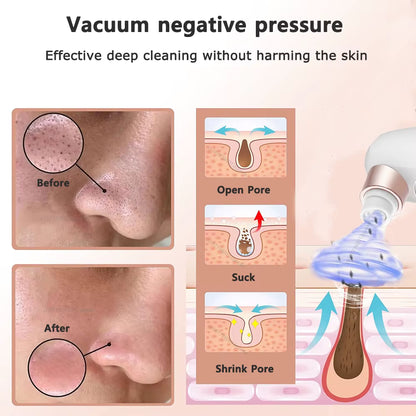 ClearPore Pro Vac